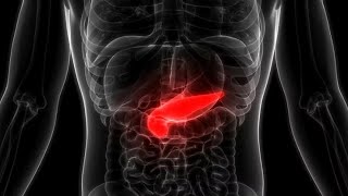 Fisiopatología da Pancreatite Aguda  Dra Emilly C Sousa Macedo [upl. by Aihsad312]