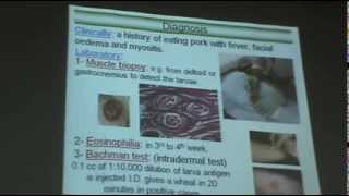 DrAzza Parasitology  Nematodes 6  Tissue Nematodes [upl. by Ylaek131]