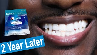 Crest 3D Whitestrips 2 Years Later How to Whiten Teeth EASY [upl. by Scottie]