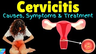 Cervicitis – Symptoms Causes Diagnosis Treatment Complications Prognosis [upl. by Reggis]