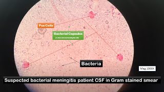 Capsules of Bacteria Microscopy at various Mangifications [upl. by Henson]