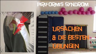 Die besten Übungen gegen das PiriformisSyndrom [upl. by Nerrual194]