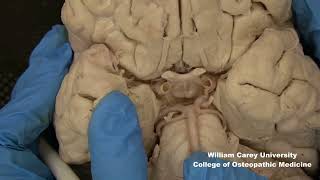 Ventral brainstemhypothalamus neuroanatomy hypothalamus brainstem anatomymedicalstudentbrain [upl. by Erida]