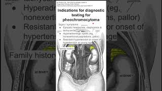 Indications for diagnostic testing for pheochromocytoma [upl. by Ruelu925]