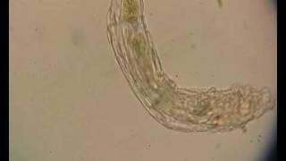 Rotifer [upl. by Lyrehc378]