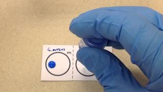 Microbiology  Coagulase [upl. by Merline]