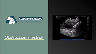Obstrucción intestinal [upl. by Ahselet]