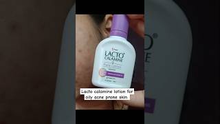 Lacto calamine face lotion review lacto calamine lotion for acne prone skin review shorts [upl. by Nitsu]